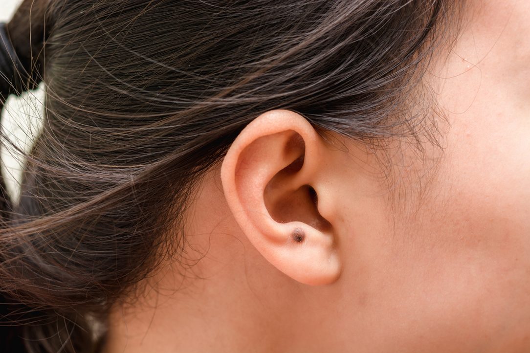 Common Ear Cancer Symptoms Zacs Legacy Foundation