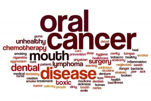 oral cavity cancer staging