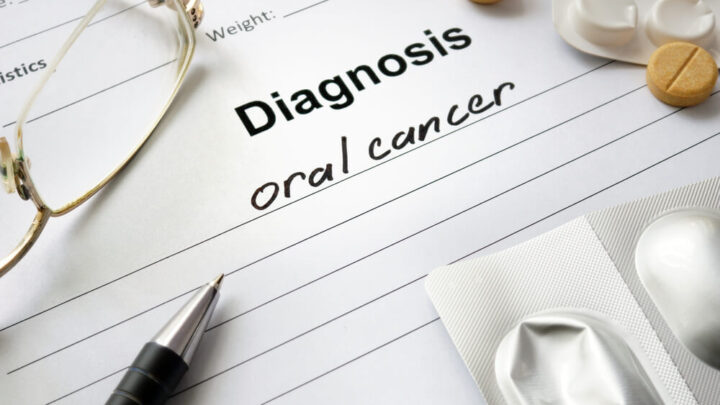 Signs Of Mouth Cancer: Who Is At Risk And How To Reduce It