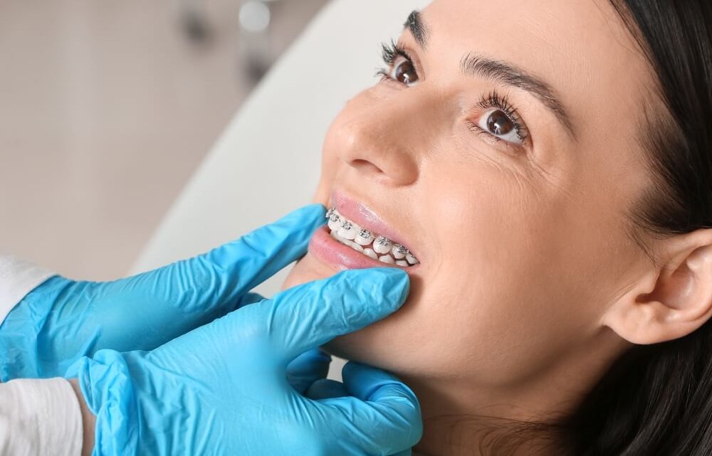 Root Resorption Braces: Unveiling the Connection