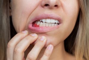 gum health vitamins disease